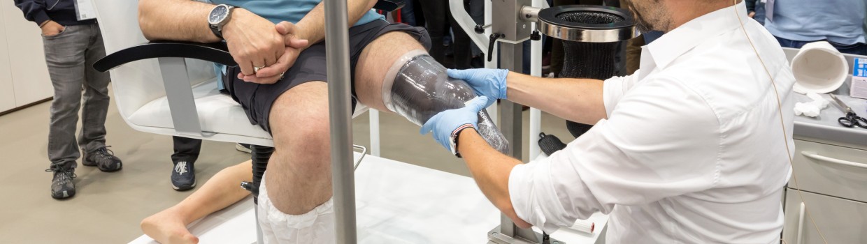 Ein Mann sitzt auf der OTWorld auf einem Stuhl, während ihm ein Orthopädietechniker einen durchsichtigen Guss für eine Beinprothese anpasst; zahlreiche Messebesucher beobachten die Demonstration im Hintergrund. Ein Mann sitzt auf der OTWorld auf einem Stuhl, während ihm ein Orthopädietechniker einen durchsichtigen Guss für eine Beinprothese anpasst; zahlreiche Messebesucher beobachten die Demonstration im Hintergrund.
