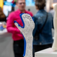 Modernly designed hand orthosis with 3D-printed honeycomb pattern and blue accents on display at OTWorld, with trade fair visitors conversing in the background