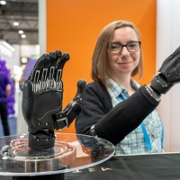 An exhibitor proudly showcases a high-tech prosthetic hand at OTWorld.