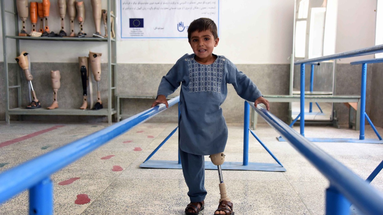 A young boy with a leg prosthesis balances between two blue handrails in a rehabilitation center. Prosthetic limbs are displayed on shelves in the background. A young boy with a leg prosthesis balances between two blue handrails in a rehabilitation center. Prosthetic limbs are displayed on shelves in the background.
